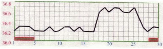 基礎体温表で見る体の状態②　低温期が長く、高温期が短い