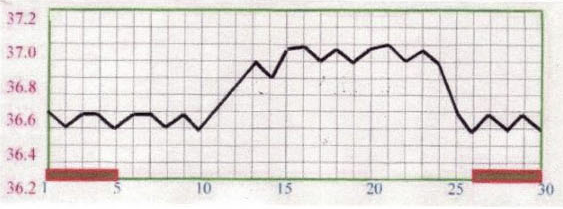 基礎体温表で見る体の状態⑦　低温期が短い、低温期の体温が高い