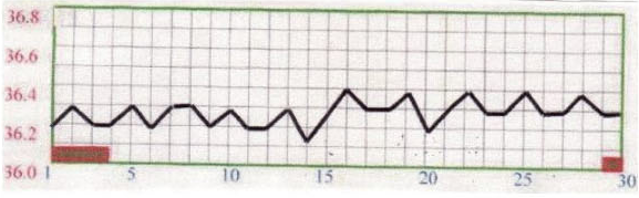 基礎体温表で見る体の状態⑧　高温期がない